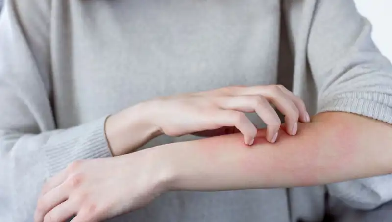 Dermatologdan Korkutan Açıklama: Cilt Kanseri İçin İki Önemli Belirti