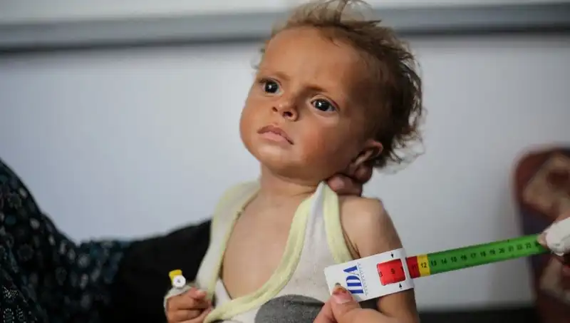İngiltere, Gazzeli Çocuklara Yeni Bir Yaşam Umudu Sunacak