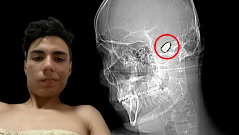 İçsel Çatışmalar: Kafasında Patlayıcıyla Yaşayanların Hikayesi
